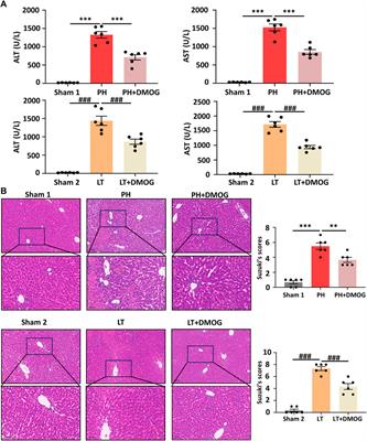 Dimethyloxalylglycine pretreatment of living donor alleviates both donor and graft liver ischemia-reperfusion injury in rats